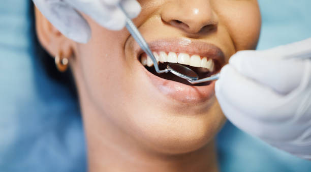 Best Emergency Dental Care for Broken or Chipped Teeth in Alta Sierra, CA